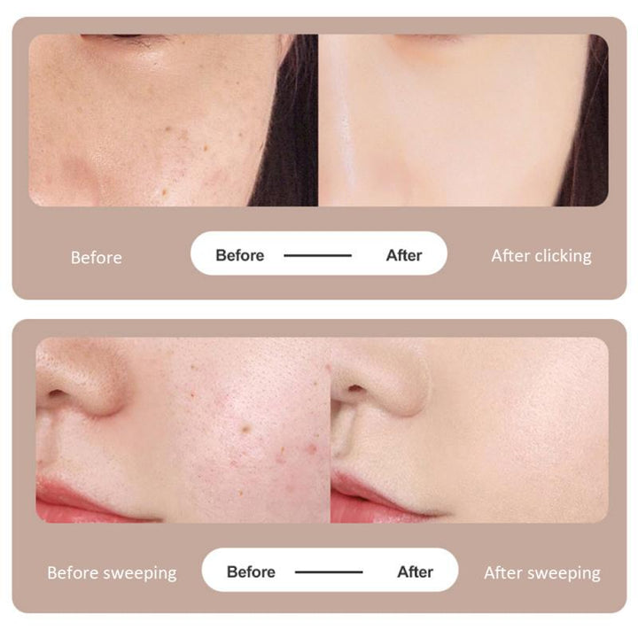 Plasma Pen — Skin Tag & Mole Removal, Zero Pain & Scarring