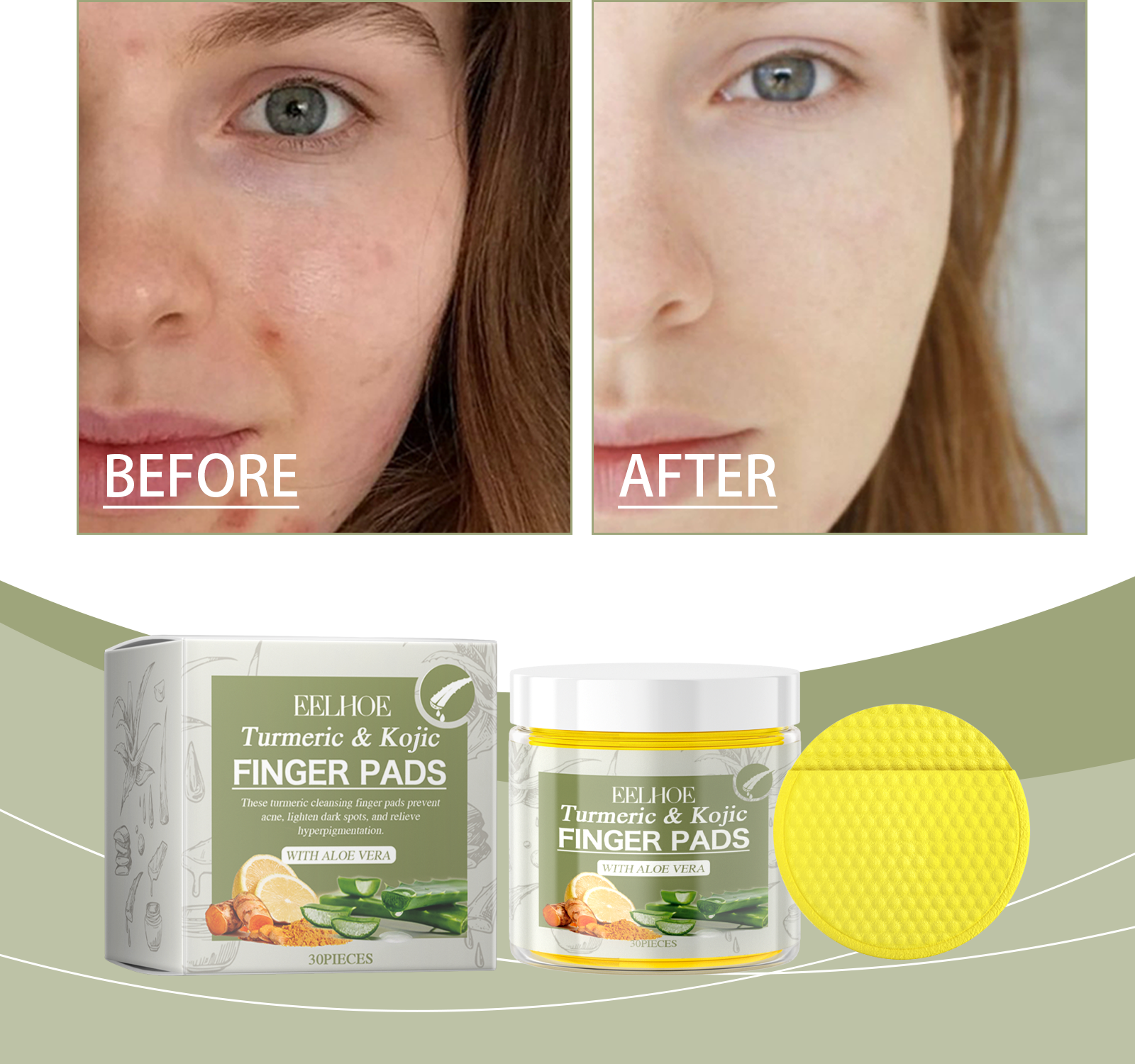 Close-up of woman's face with callout cards describing 'Revent Acne' and 'Lighten Dark Spots' benefits with ingredient imagery