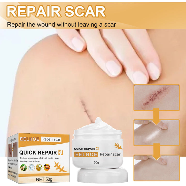 Scar Repair Cream — Fades Scars & Restores Smooth Skin