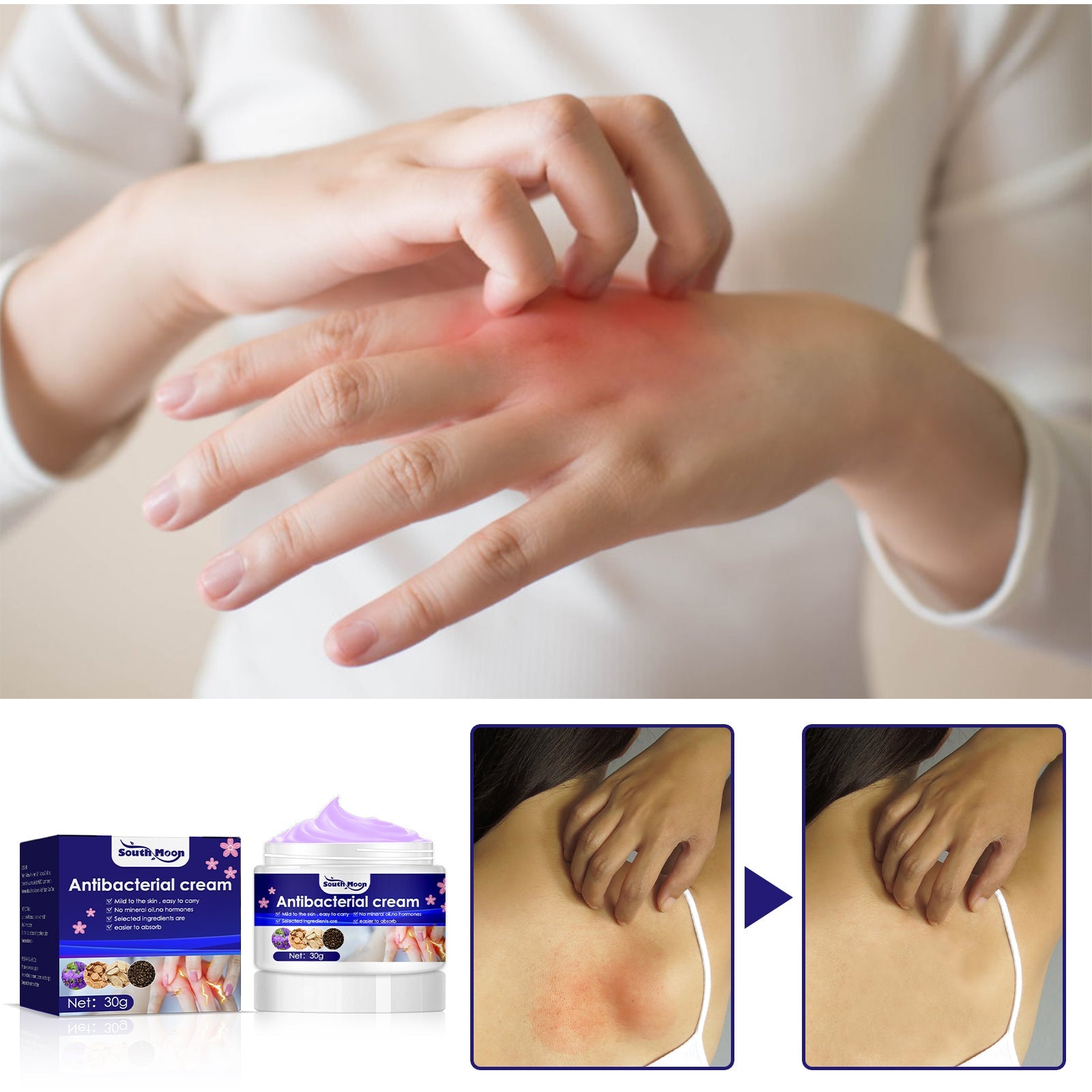 Woman in white sweater applying cream to inner arm/hand with visible redness, demonstrating product absorption and real-world application