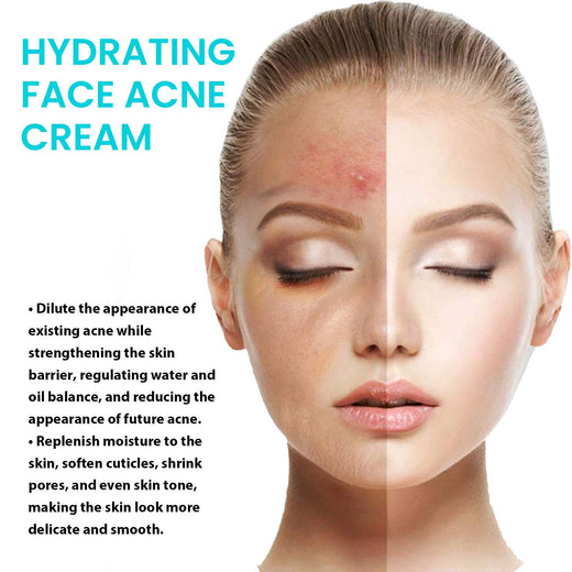 Brightening Acne Cream for Hydrated, Even-Looking Skin