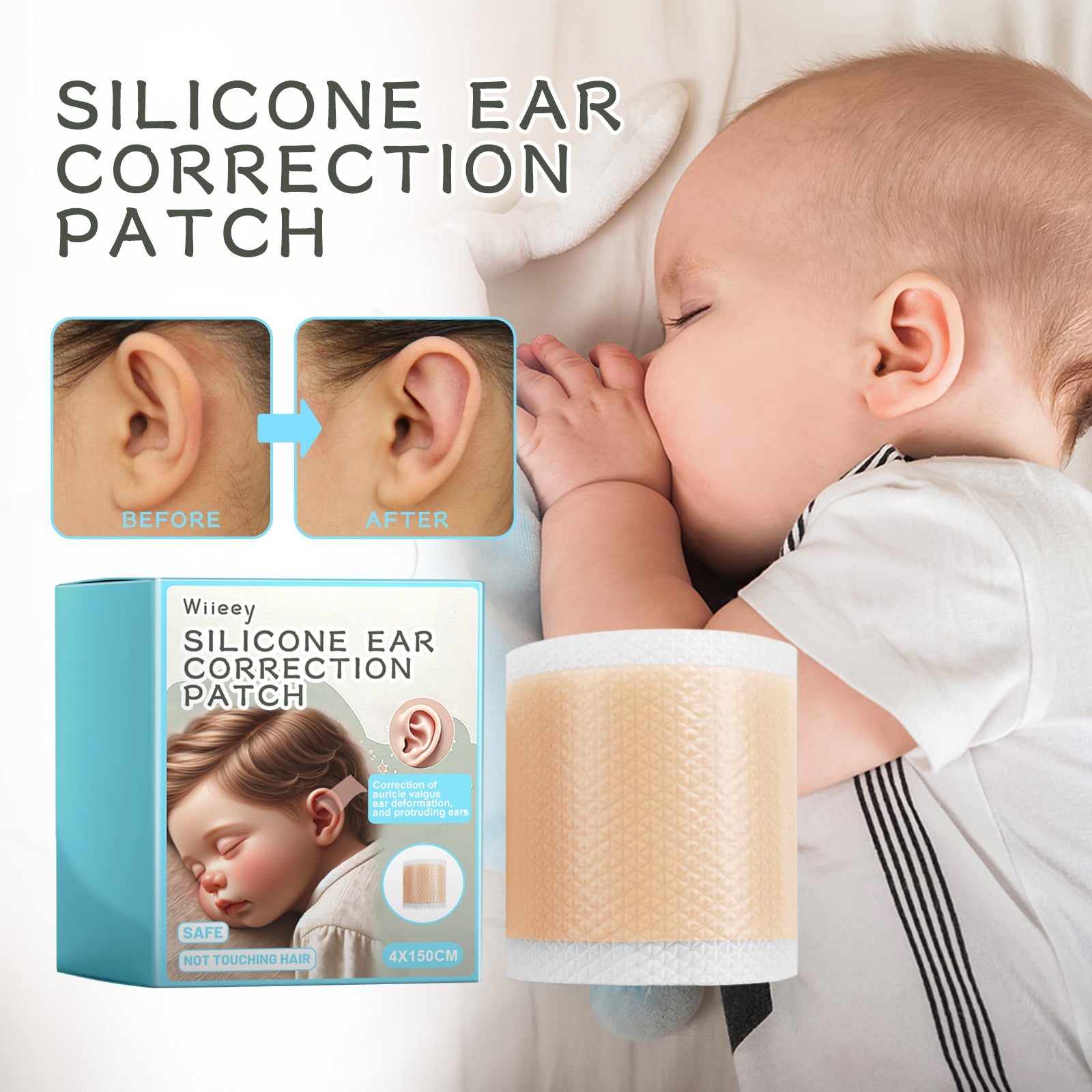 Educational comparison grid showing four types of children's ear problems: protruding ears, flipped ears, squeezed ear shape, and windward ears on infants and toddlers