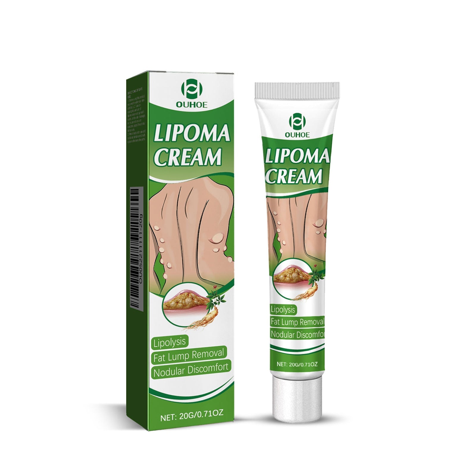 OUHOE Lipoma Cream product packaging and tube on white background, duplicate angle