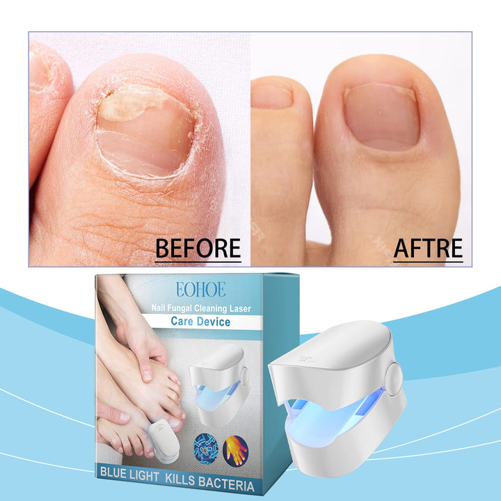 Blue Light Nail Care Device for Healthier-Looking Nails