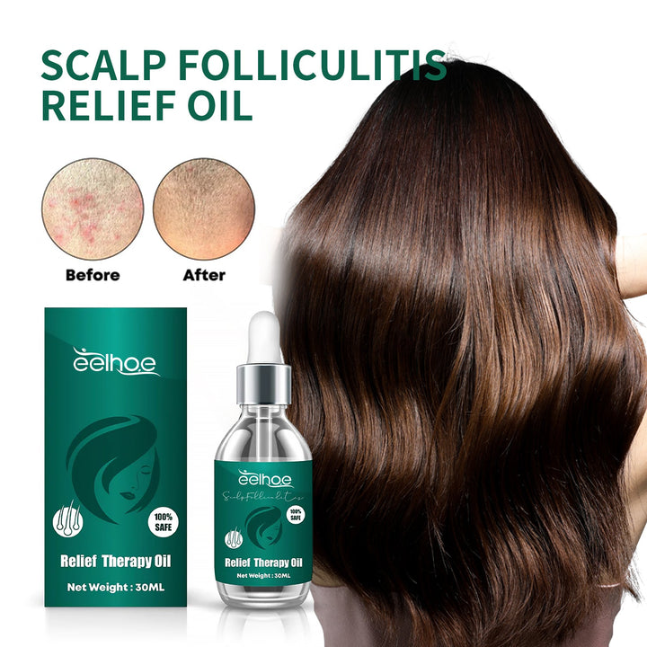 Scalp Serum for Dandruff and Follicle Relief