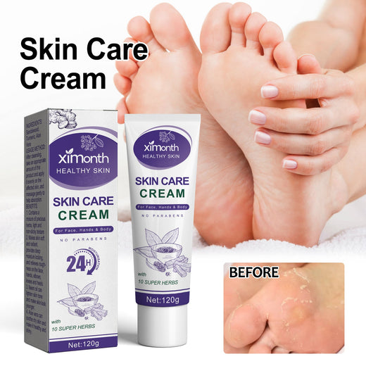 Herbal Body Cream for Cracked Heels & Dry Winter Skin