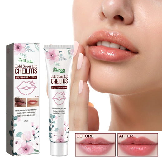 Lip Repair Cream for Chapped Lips & Cold Sore Relief