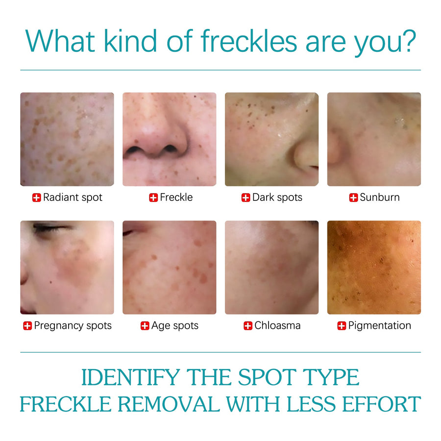 Niacinamide Serum for Dark Spots & Brighter-Looking Skin