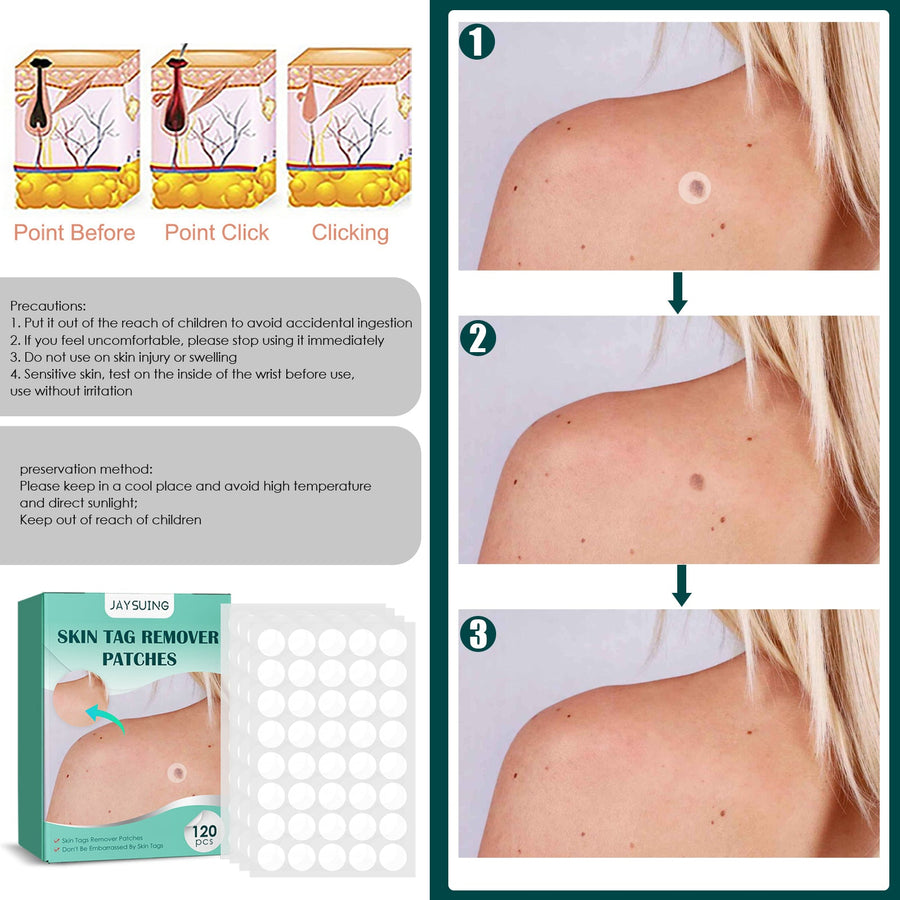 Skin Tag Remover Patches for Discreet Daily Care