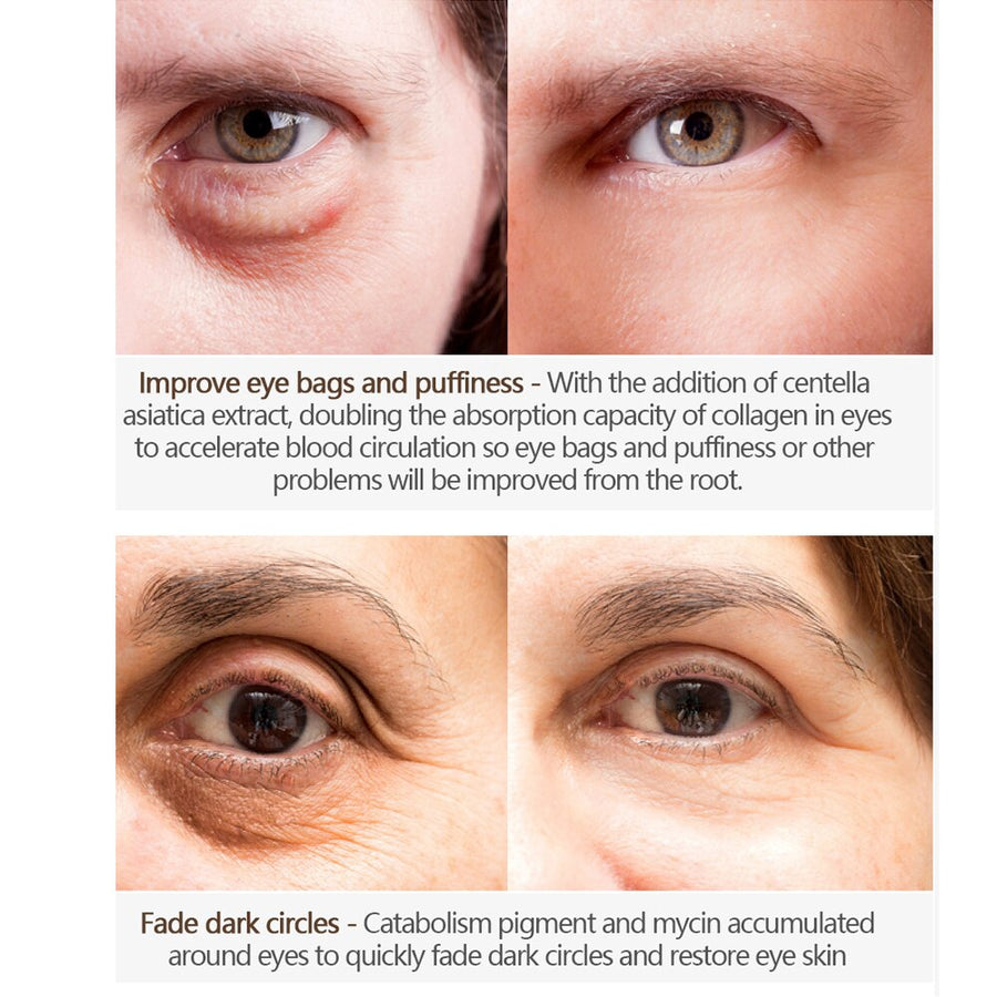 Eye Cream for Dark Circles, Puffiness & Fine Lines