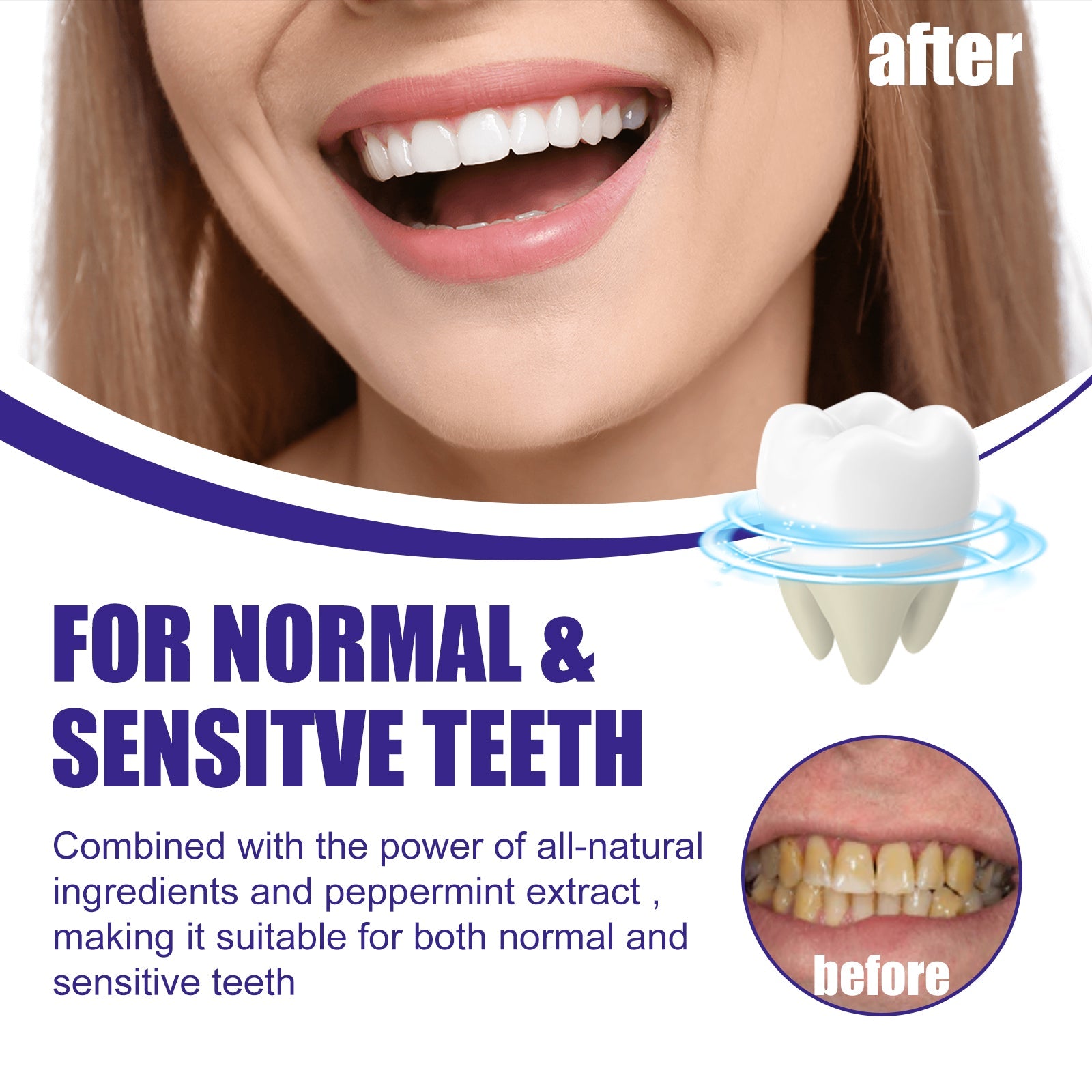 Dramatic before/after smile transformation with close-up comparisons showing yellow stained teeth becoming brilliantly white