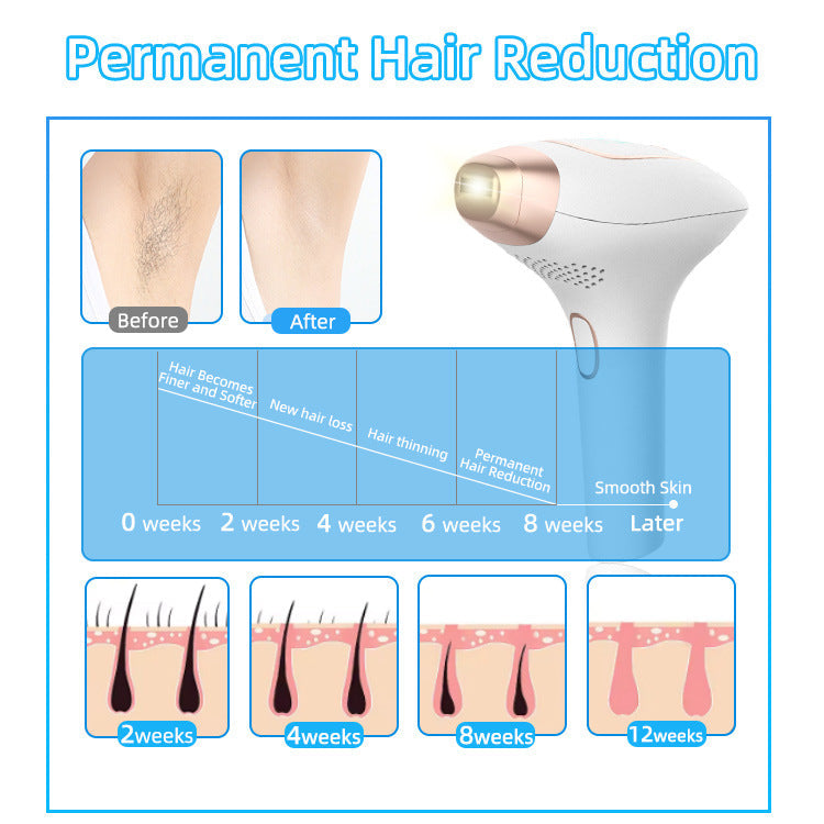 IPL Hair Remover with Ice Cooling — Smooth Skin in 8 Weeks