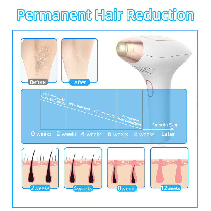 IPL Hair Remover with Ice Cooling — Smooth Skin in 8 Weeks