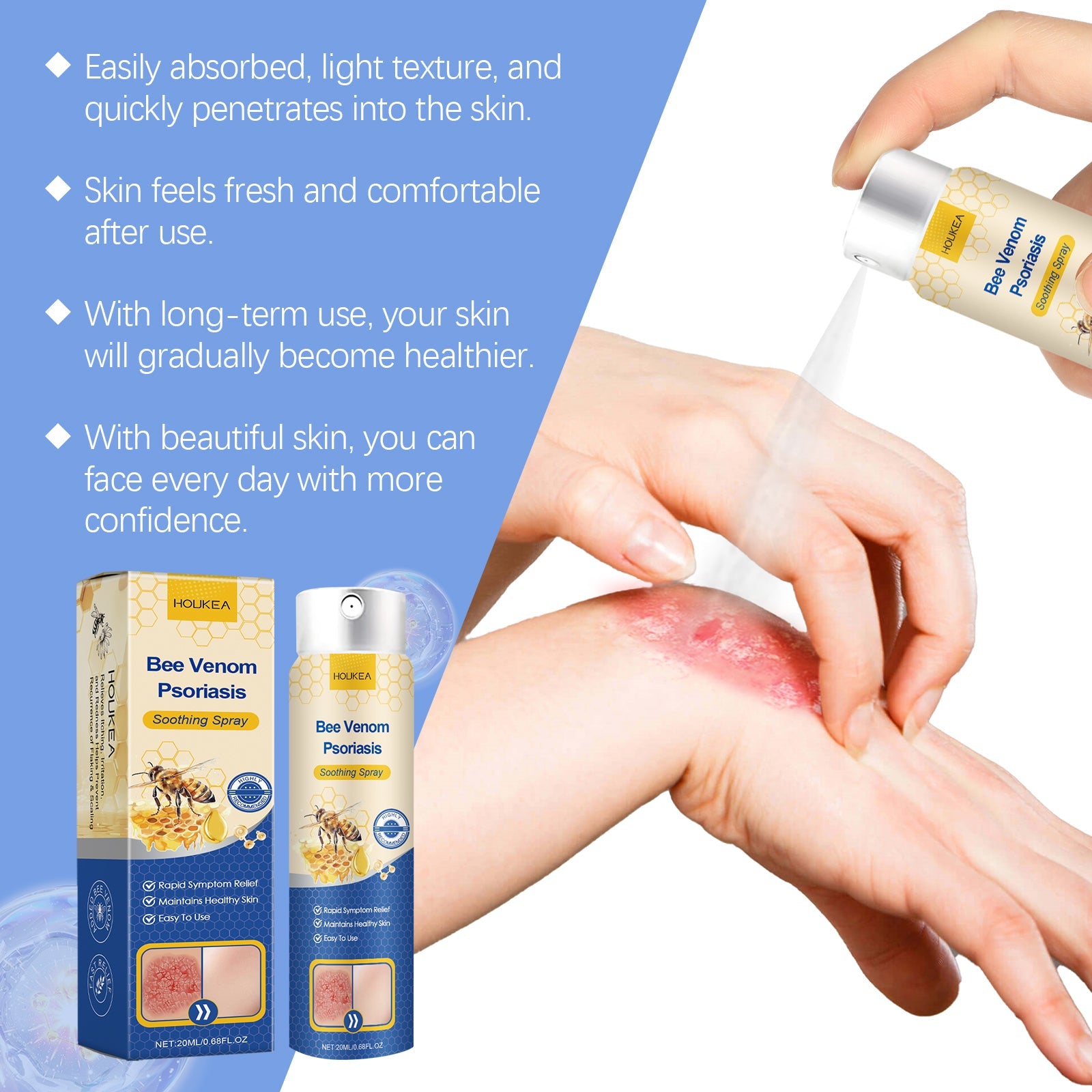 Close-up of hands spraying product on visible psoriasis patch with product benefits listed on left side