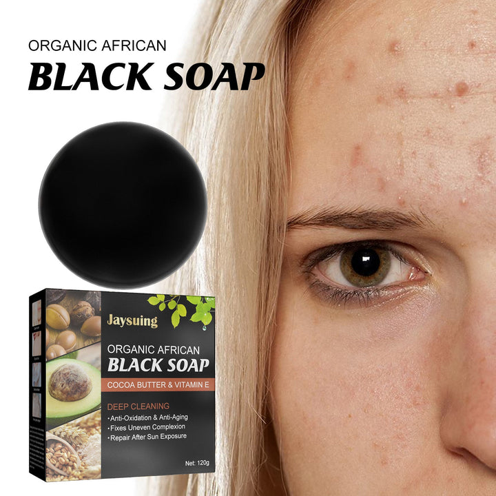 African Black Soap Bar for Acne-Prone Skin & Body
