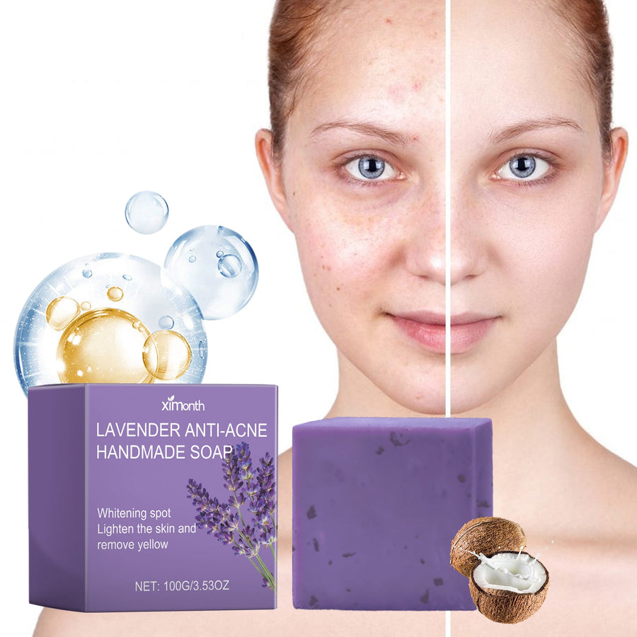 Lavender Acne Soap Bar For Oily Skin Pore Control