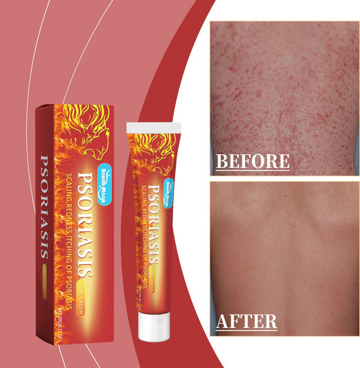 Soothing Skin Cream for Dry, Irritated & Redness-Prone Skin
