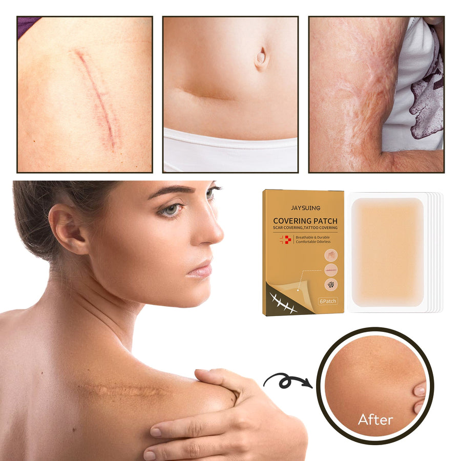Skin Concealer Patch for Invisible Scar & Tattoo Cover