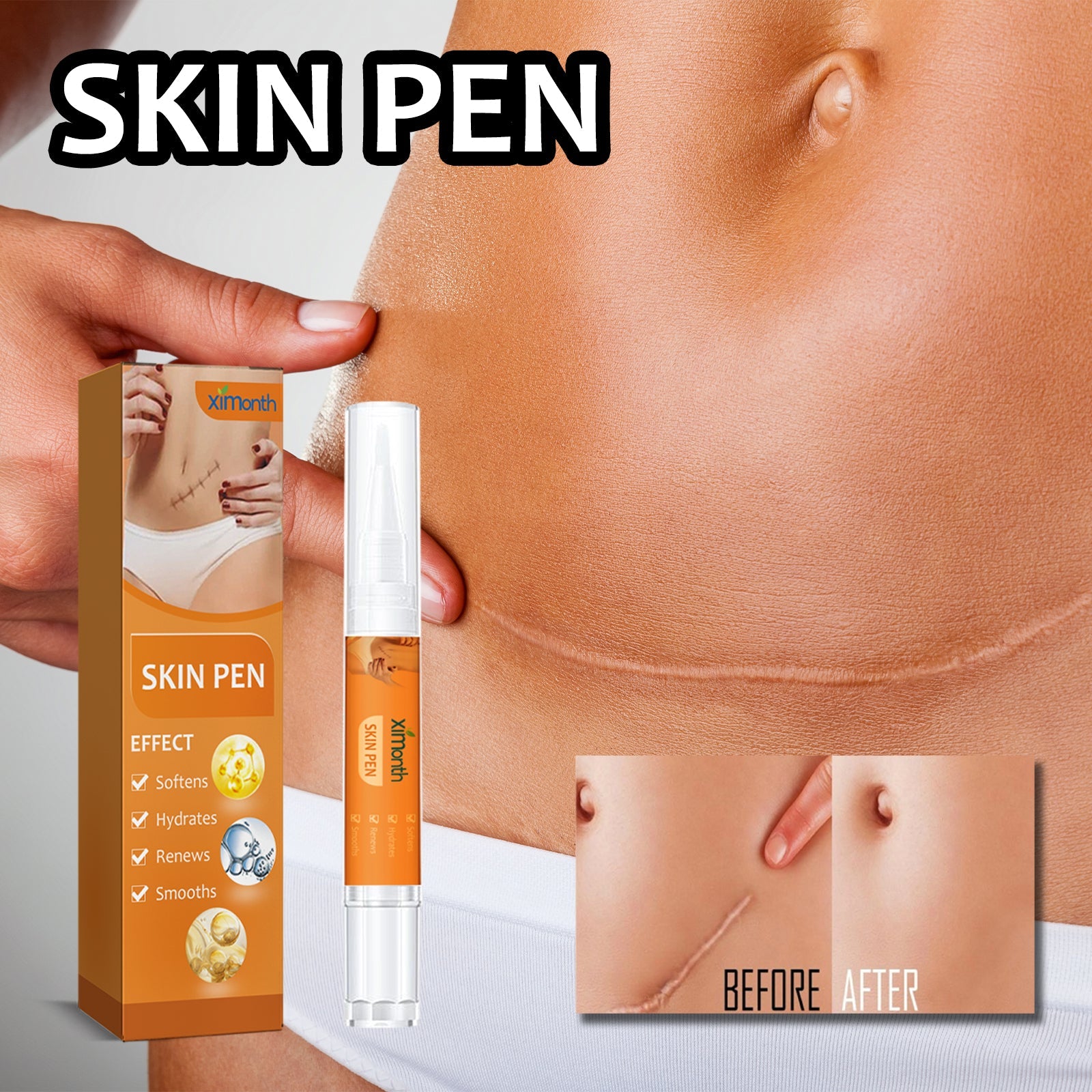 Duplicate hero image of packaging and pen product from alternative angle