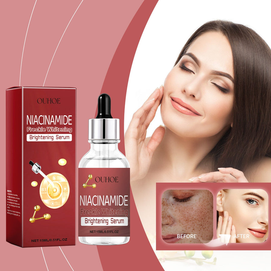 Freckle Serum with Niacinamide for Even Skin Tone