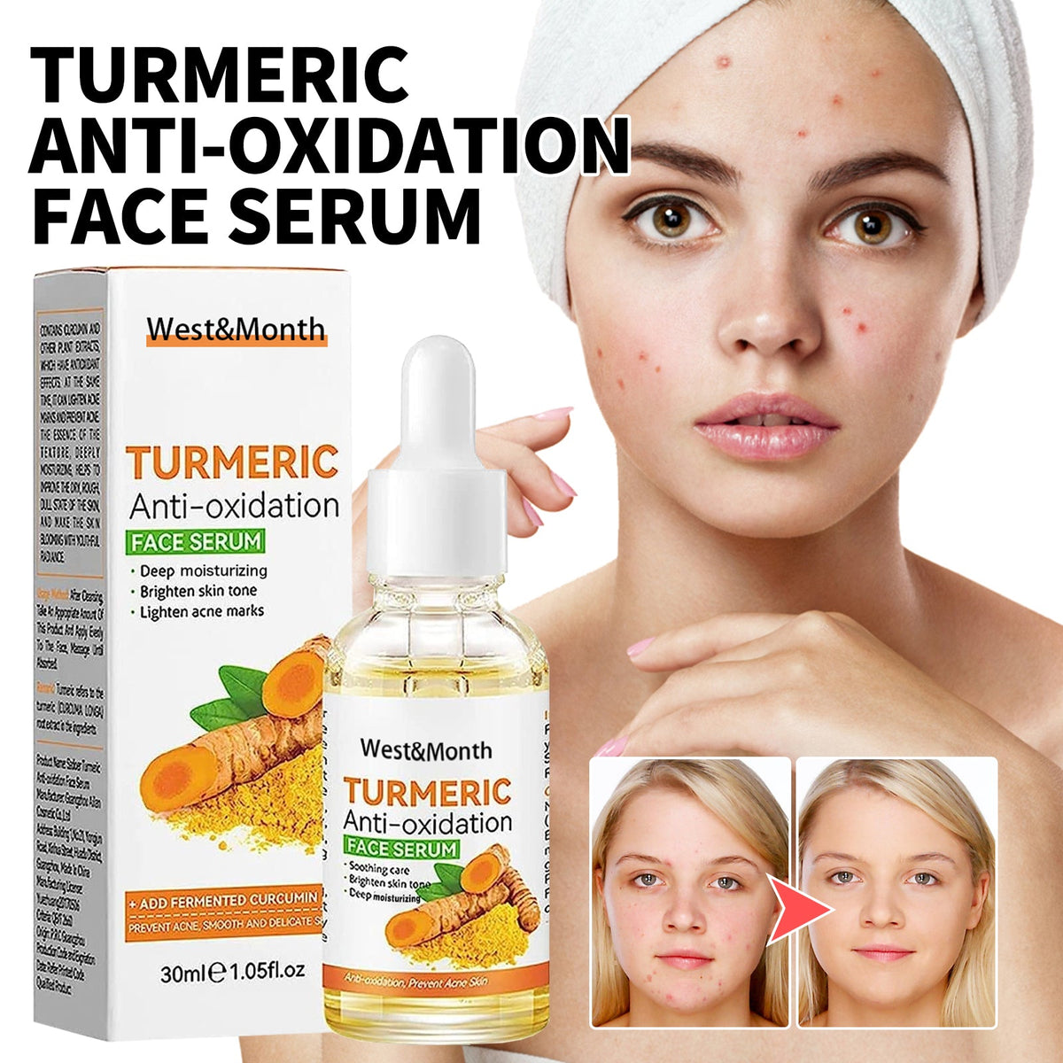Turmeric Facial Essence for Acne Marks & Dark Spots