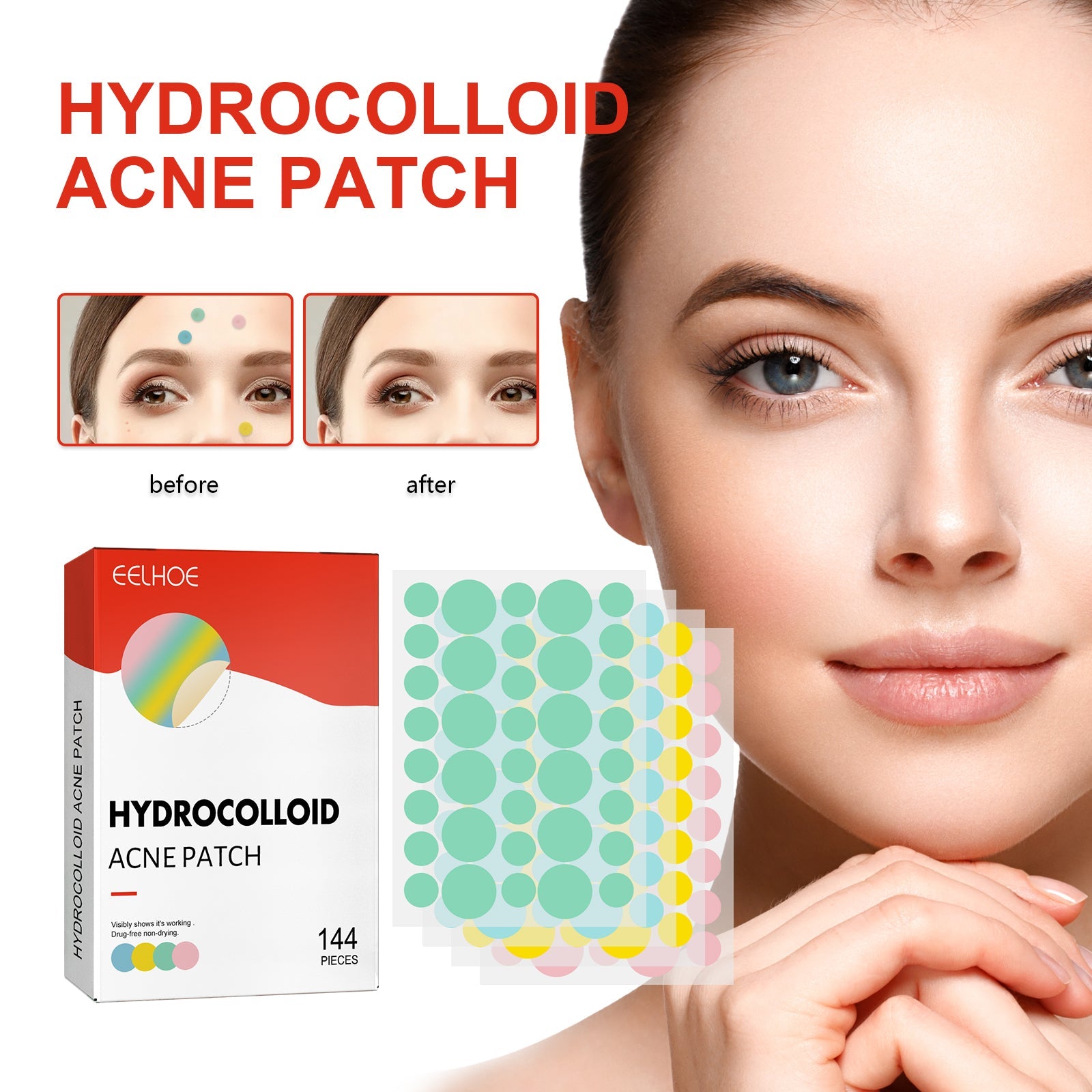 Infographic with woman's face and labeled diagrams showing patch benefits: acne breakouts, pus absorption, inflammation reduction, isolation formation, and skin coverage