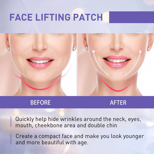 V-Shaped Face Lifting Patches for Temporary Contour