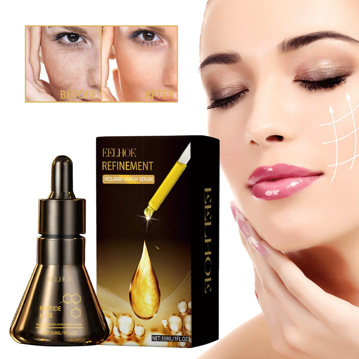 Melanin Vanish Brightening Serum for Dark Spots & Melasma