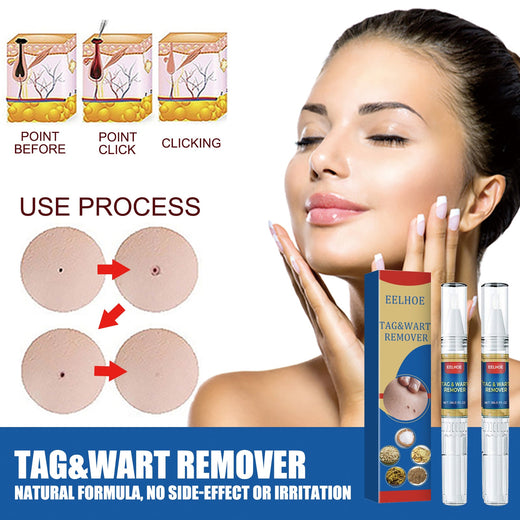 Skin Tag Treatment Pen for Precise At-Home Spot Care