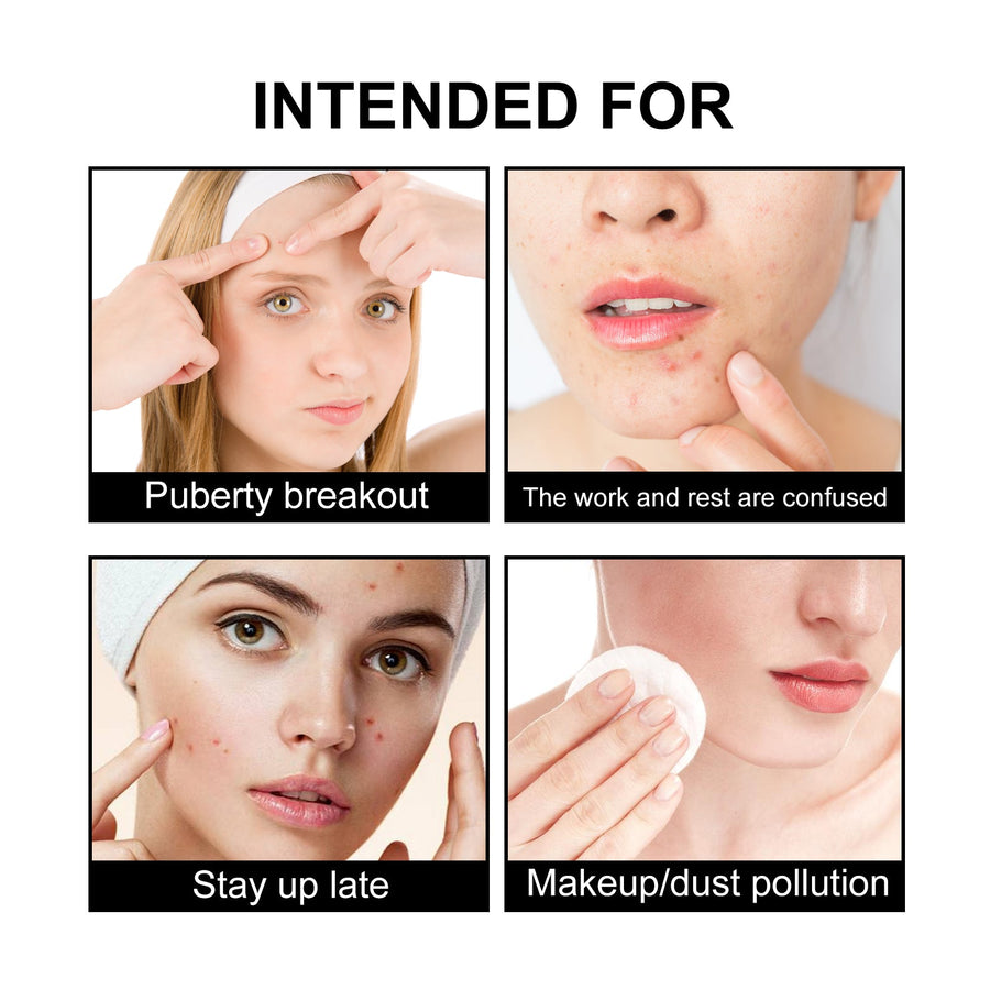 Black Acne Patches for Calming and Covering Blemishes