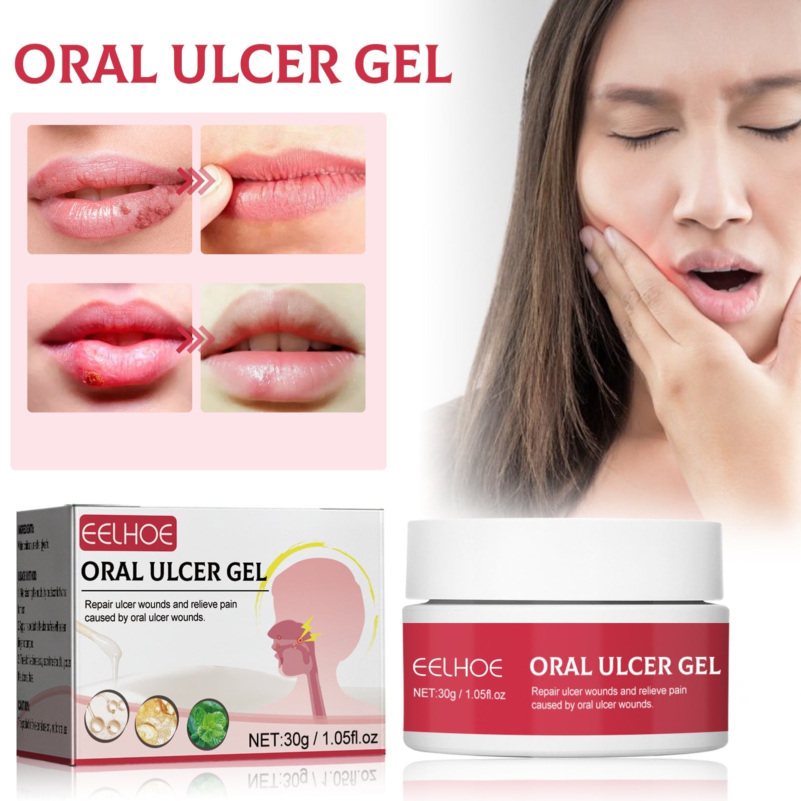 Problem identification grid showing four oral ulcer conditions: mouth ulcer, swelling and aching of gum, ulceration of corners of mouth, mouth blister