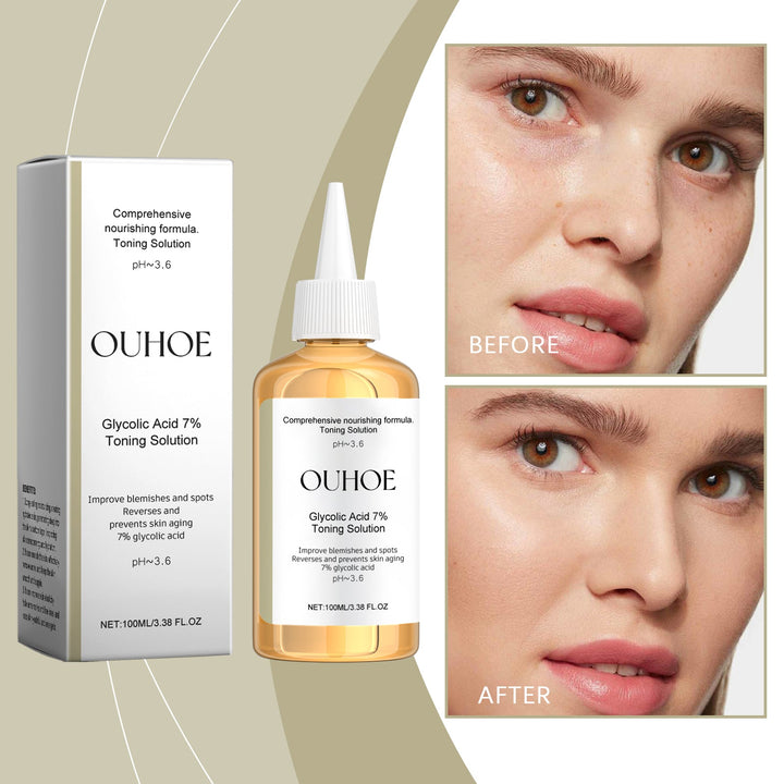 Glycolic Acid 7% Toner for Acne Scars & Uneven Tone