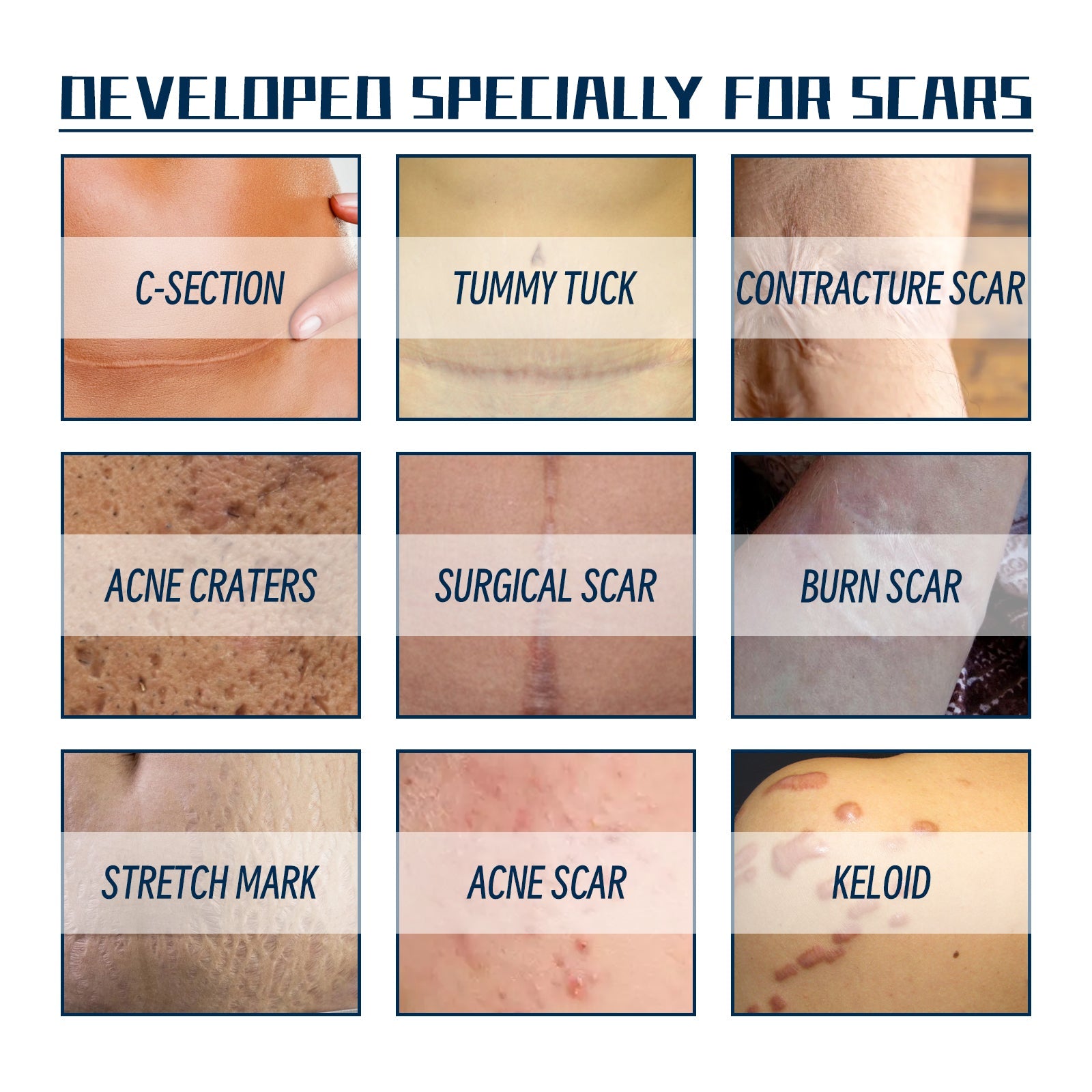 Close-up before/after comparison of facial surgical scar with visible redness reduction and skin smoothing effect
