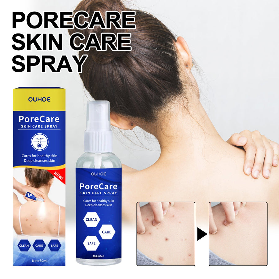 Porecare Skin Care Spray, Cleanser Warts Fade Moles Corns Sm