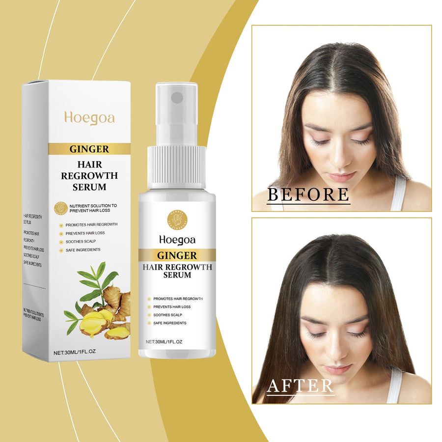 Ginger Scalp Serum Spray for Fuller-Looking Hair Care