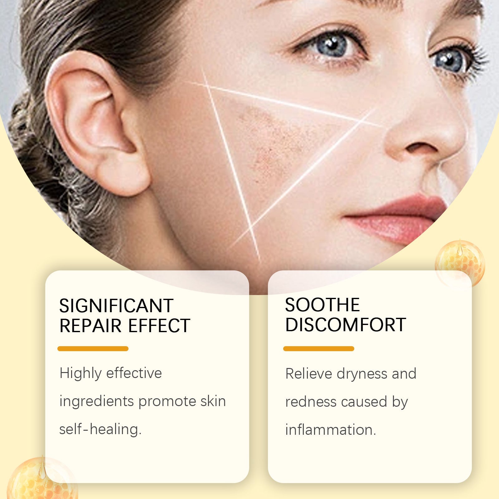 Woman's face in profile with repair area highlighted; text boxes emphasizing 'Significant Repair Effect' and 'Soothe Discomfort'
