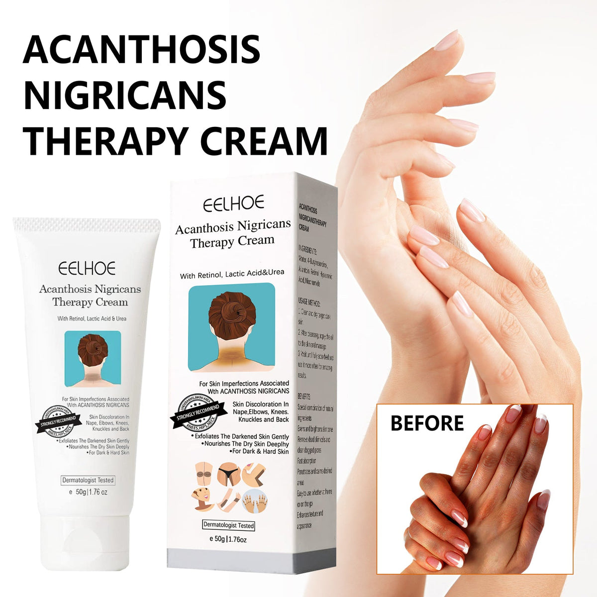 Dark Spot Repair Cream for Underarms, Elbows & Knees