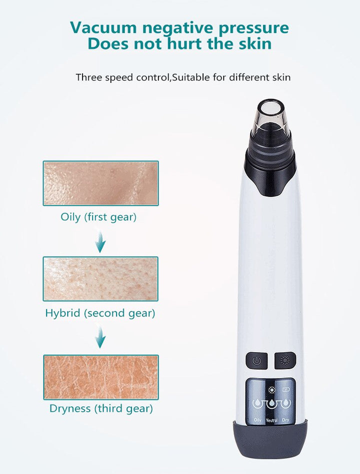Facial Pore Vacuum Cleaner — Safe Blackhead Removal & Pore