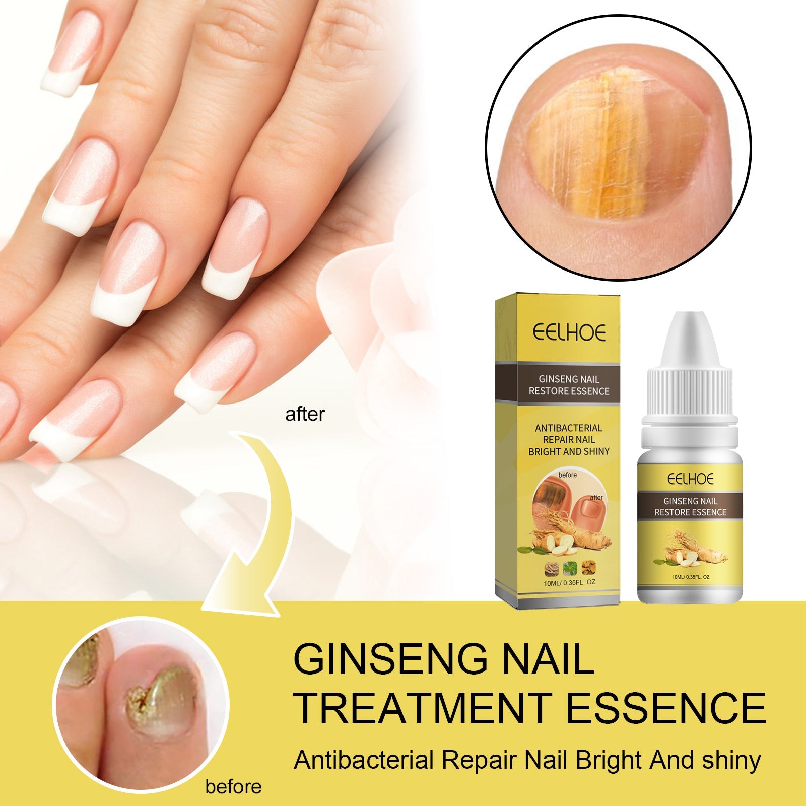 Healthy manicured nails showing French tips and nail damage close-up, plus product with before/after nail transformation