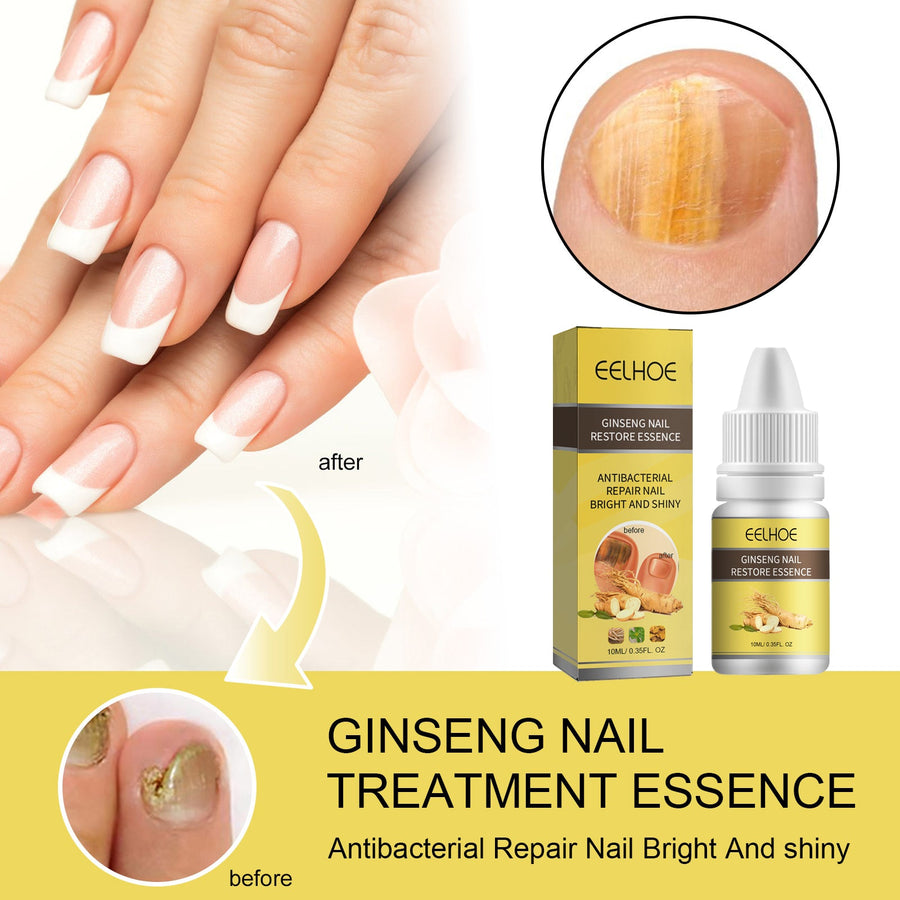 Ginseng Nail Repair Essence — Brighten & Strengthen Damaged Nails
