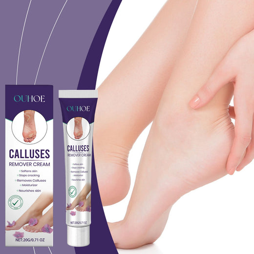 Foot Callus Removal Cream for Soft, Crack-Free Heels