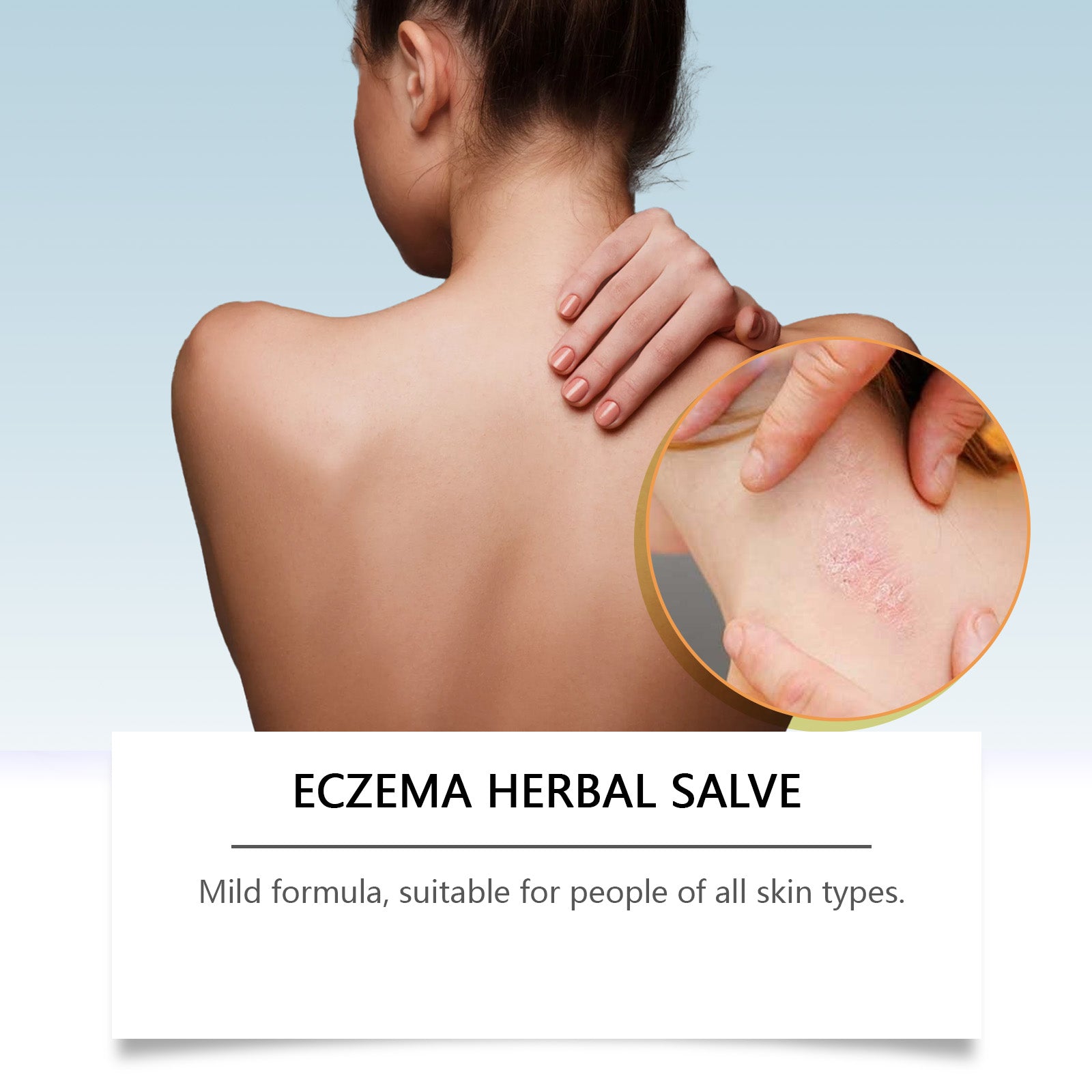 Left side shows benefit bullets (Quick relief, Plant ingredients, Deep moisturizing, Safe and reliable) paired with product and close-up of smooth, clear healed skin on right