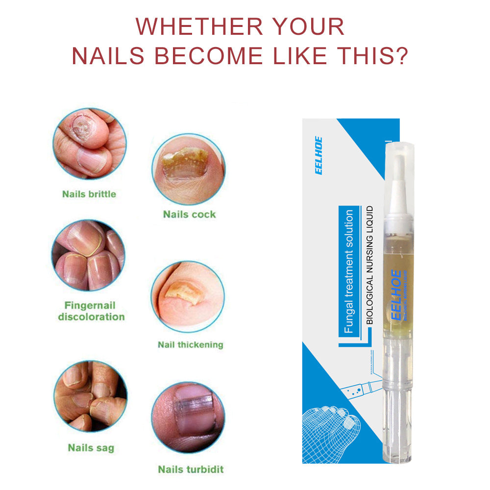 Six circular clinical close-ups of various nail fungus conditions (brittle, cock, discoloration, thickening, sag, turbidity) with product box positioned as solution