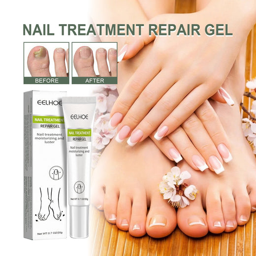 Nail Repair Gel for Damaged, Discolored, Brittle Nails