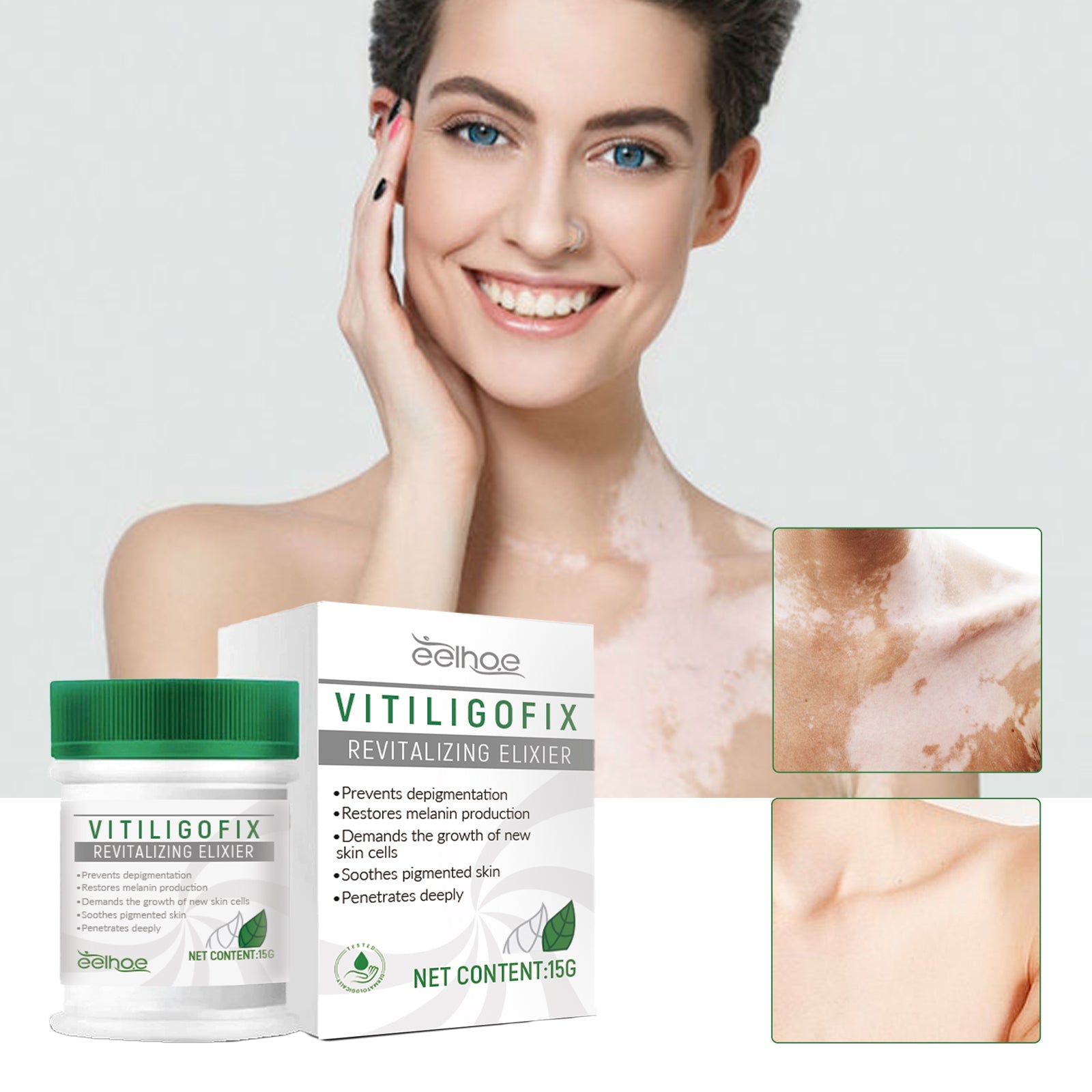 Happy smiling woman with clear, even-toned skin holding product box, with close-up detail boxes showing treated skin areas with improved pigmentation