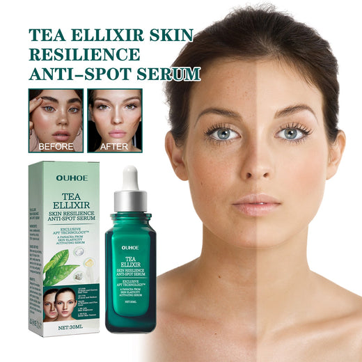 Brightening Blemish Essence for Dark Spots & Melasma