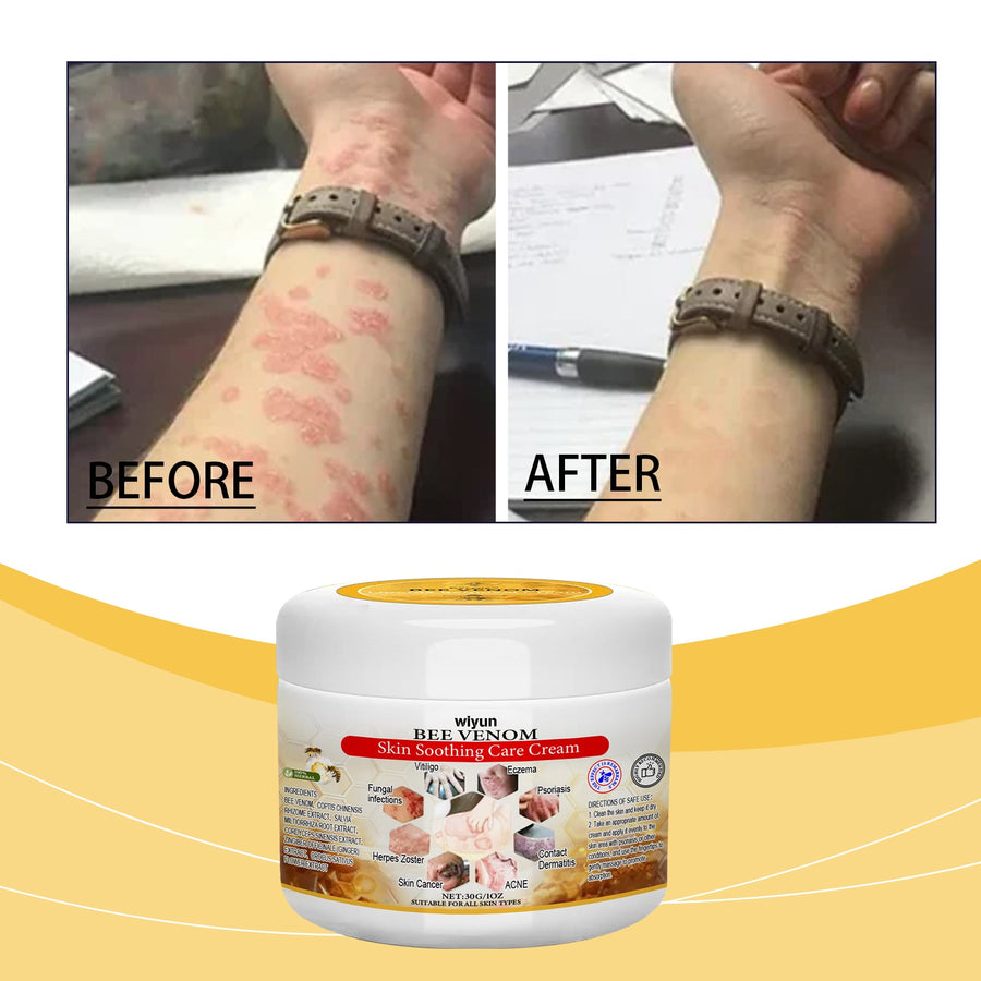 Bee Venom Cream for Dry, Irritated & Troubled Skin