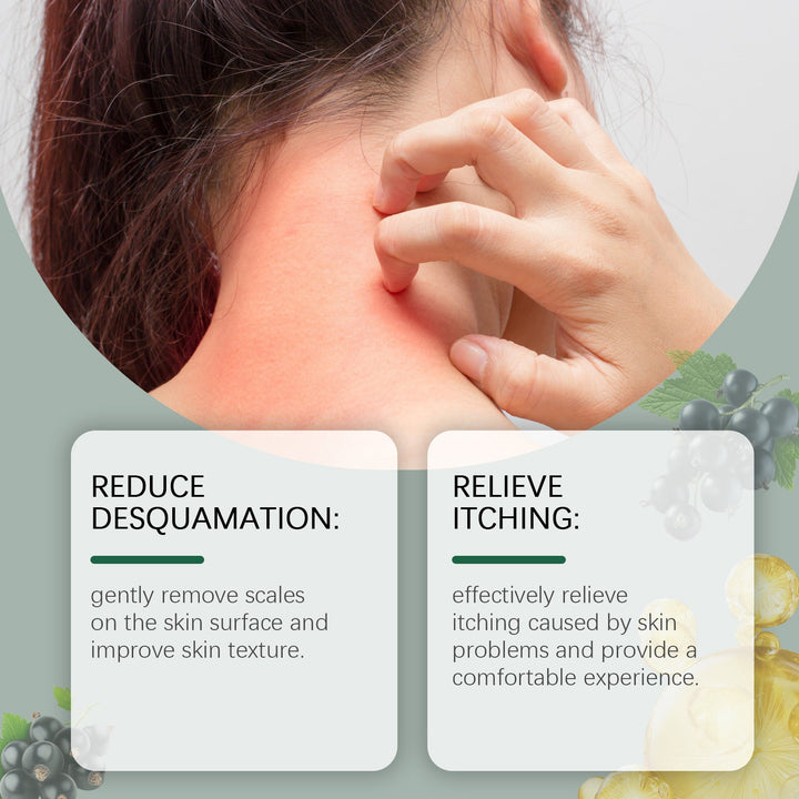 OceAura Repair Soap for Eczema & Psoriasis Relief