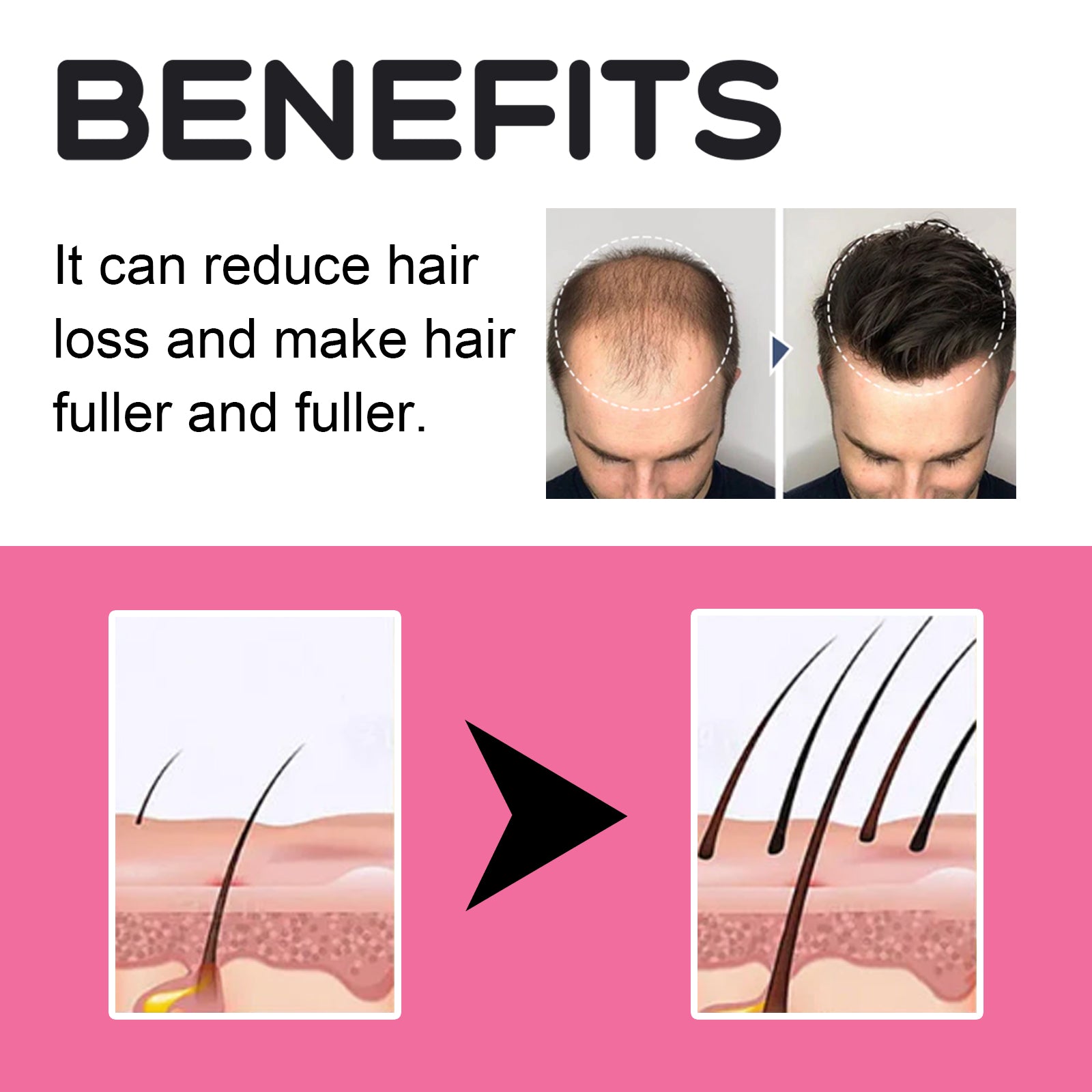 Male scalp before and after showing hair regrowth and fuller hairline