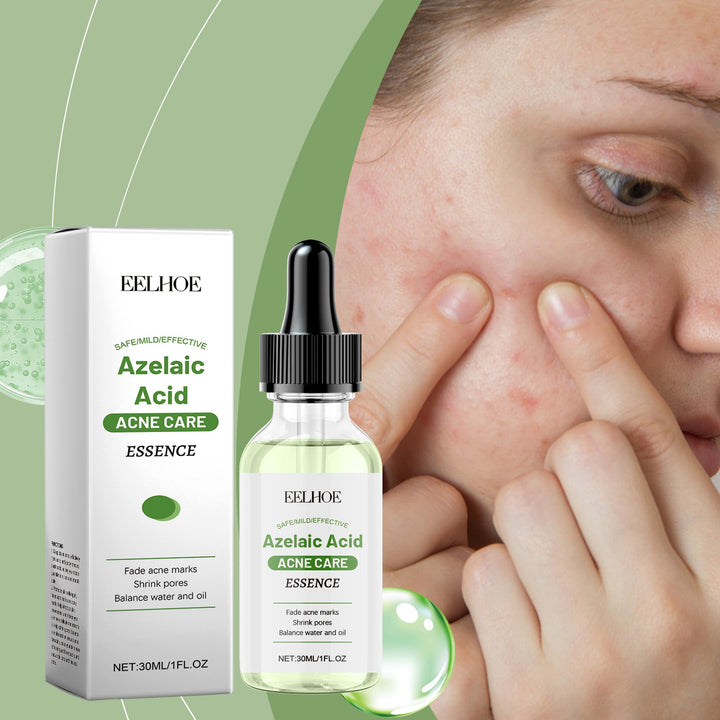 Azelaic Acid Essence for Blackheads, Pores & Acne Marks